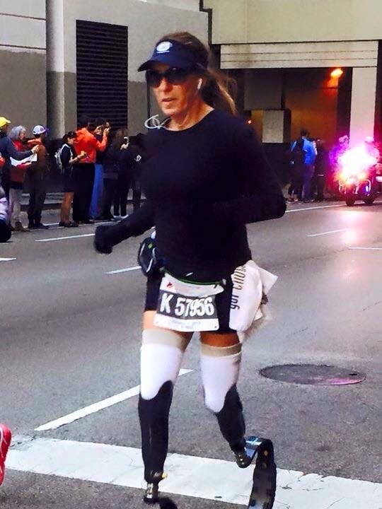 Never Give Up! EastPoint Prosthetics & Orthotics